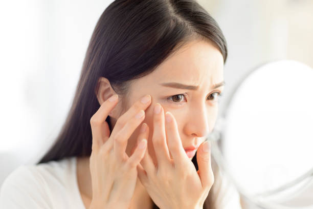 istock Young woman looking at  mirror and checking the  acne problem at home 1328406561