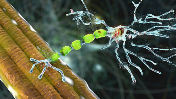 Degradation of motor neurons, conceptual 3D illustration Degradation of motor neurons, conceptual 3D illustration. Motor neuron diseases are a group of neurodegenerative disorders including amyotrophic lateral sclerosis, progressive bulbar palsy and other medulla stock pictures, royalty-free photos & images