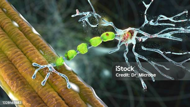 Degradation Of Motor Neurons Conceptual 3d Illustration Stock Photo - Download Image Now