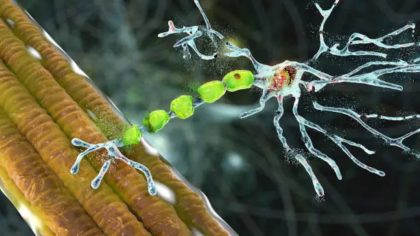 Photo of Degradation of motor neurons, conceptual 3D illustration
