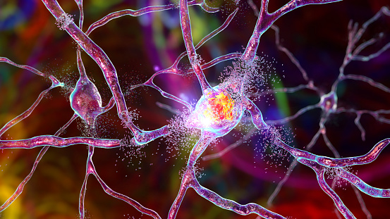 Destrucción de neuronas de estriado dorsal, ilustración conceptual en 3D photo