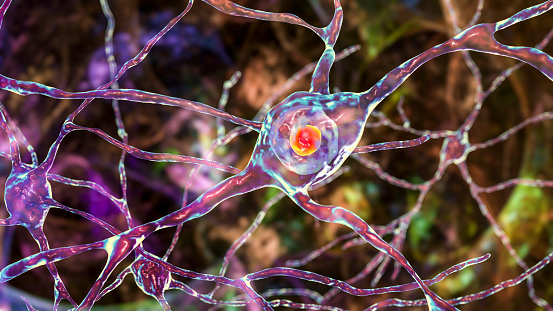 Intranuclear neuronal inclusions, 3D illustration. Intranuclear inclusions in neurons are found in different neurodegenerative diseases, including Huntingon's disease, spinocerebellar ataxia and other