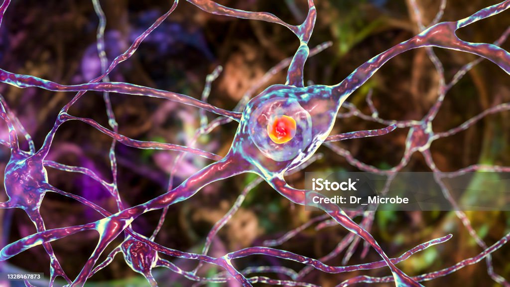 Neuronal intranuclear inclusions, 3D illustration Intranuclear neuronal inclusions, 3D illustration. Intranuclear inclusions in neurons are found in different neurodegenerative diseases, including Huntingon's disease, spinocerebellar ataxia and other Gene Therapy Stock Photo