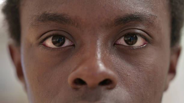 istock Blinking Eyes Young African Man Looking at the Camera 1328474588