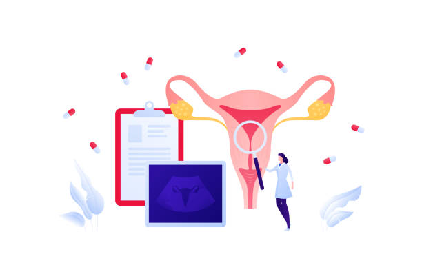 ilustrações de stock, clip art, desenhos animados e ícones de medical ultrasound procedure concept. vector flat healthcare illustration. female reproductive system and uterus diagnostic. female doctor with magnifier glass and medicine capsule symbol. - ovary