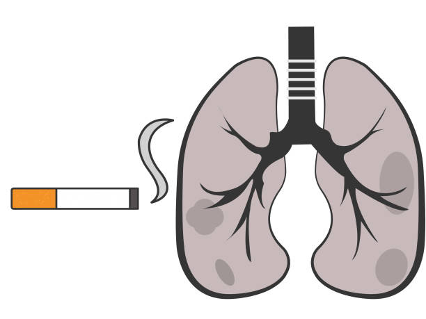 Sick lungs from smoking too much Sick lungs from smoking a lot and it isn' health cigarro stock illustrations