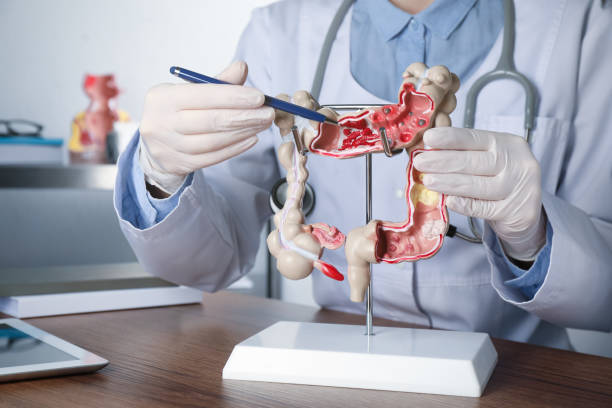gastroenterologe zeigt menschliches dickdarmmodell am tisch in der klinik, nahaufnahme - gastroenterologe stock-fotos und bilder