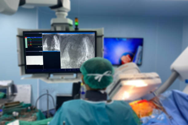 un moniteur de télévision en gros plan montre une photo de l’équipe de médecins effectuant une chirurgie cardiaque et floutant la salle d’opération - grafted photos et images de collection