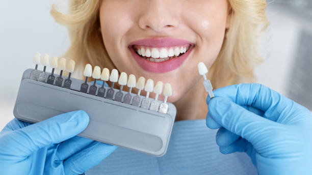 istock Dentist applying sample from tooth scale to happy patient teeth 1328844902