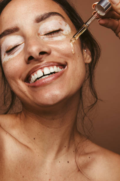 istock Skin care for vitiligo 1328847172