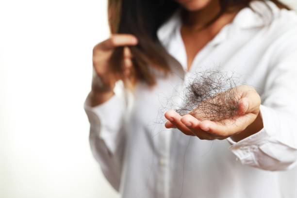 istock Scalp problems, hair loss, baldness, thinning hair 1328979449