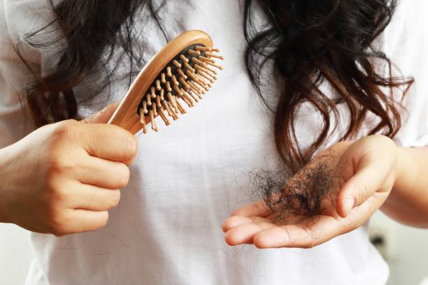 istock Scalp problems, hair loss, baldness, thinning hair 1328979515