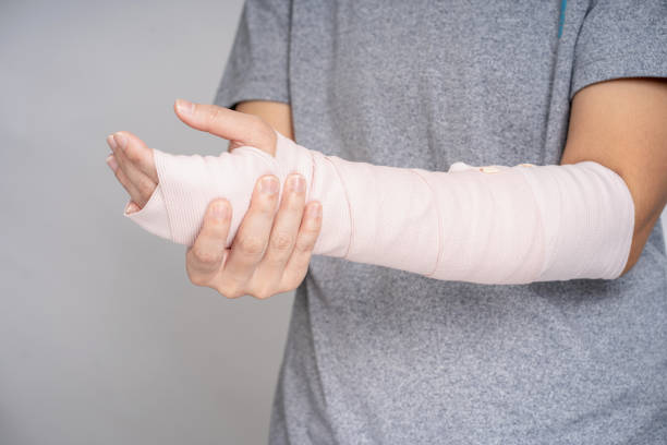 asian people broken arms from sports accidents. in the studio, injury. - physical injury men orthopedic equipment isolated on white imagens e fotografias de stock