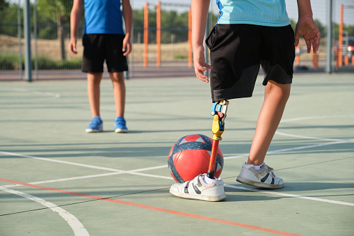 Niños irreconocibles jugando al fútbol, uno de ellos tiene una prótesis de pierna. Hermanos practicando deportes juntos. photo