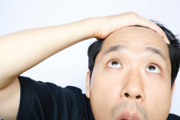 istock A man who cares about the receding bangs 1329166914