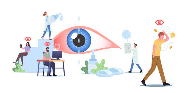 ilustrações, clipart, desenhos animados e ícones de personagens minúsculos ao redor de huge eye. pessoas sofrem de des, síndrome dos olhos secos e doença de conjuntivite visit clinic - dry