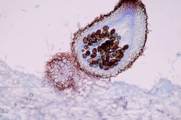 istock Host cells with spores (mold) are inside wood under the microscope for education. 1329498420