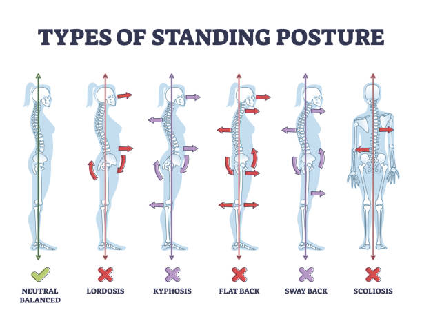 서 자세 및 의료 허리 병리학 세트 개요 다이어그램의 종류 - posture stock illustrations