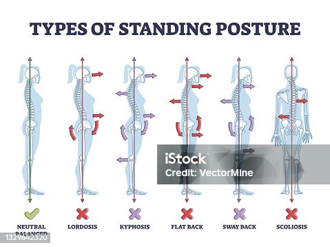 14,500+ Spine Posture Stock Photos, Pictures & Royalty-Free Images - iStock
