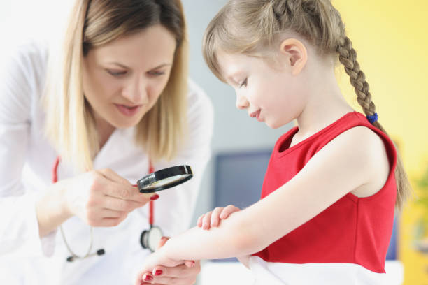 Doctor pediatrician examining rash on skin of hand of little girl using magnifying glass Doctor pediatrician examining rash on skin of hand of little girl using magnifying glass. Dermatological diseases in children concept kids with psoriasis stock pictures, royalty-free photos & images