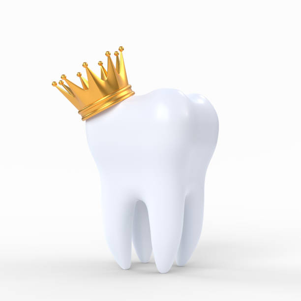 istock White human tooth crowned with a gold crown isolated on white background 1329765125