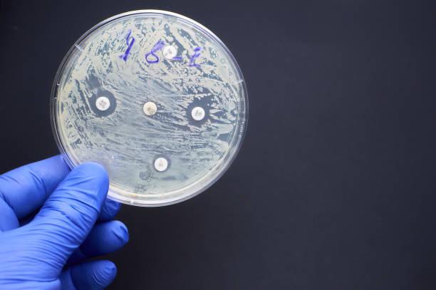 antimicrobial susceptibility by diffusion test. multidrug resistance - anti bacteria imagens e fotografias de stock