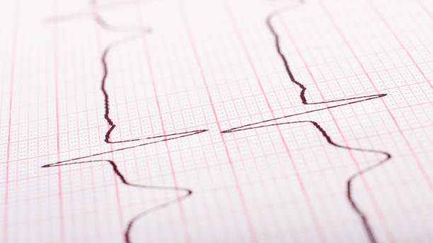 istock heart rate on paper cardiogram closeup 1329902146