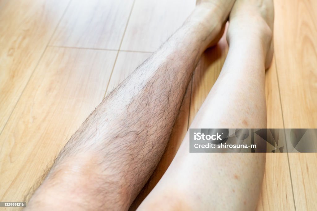 A photo of a man with shaved legs. Photos before and after shaving. Hair Removal Stock Photo