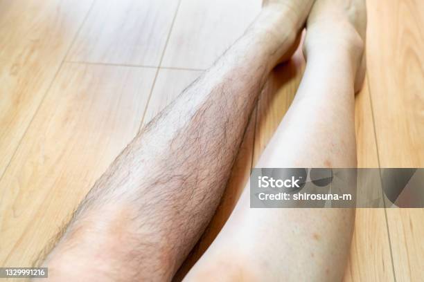 A Photo Of A Man With Shaved Legs Photos Before And After Shaving Stock Photo - Download Image Now