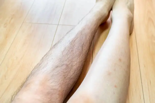 Photo of A photo of a man with shaved legs. Photos before and after shaving.