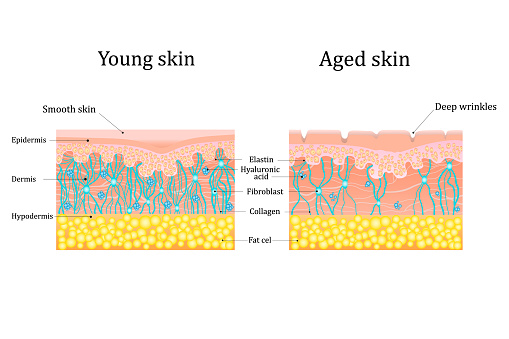 Skin aging diagrams. Comparison of young and old skin. Structure human skin with collagen and elastin fibers, fibroblasts.