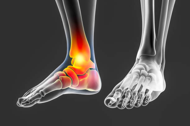 Foot and ankle pain, conceptual 3D illustration stock photo