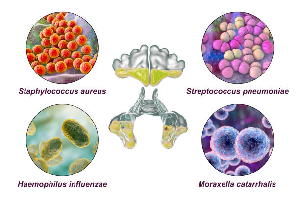 anatomía de la rinosinusitis y bacterias que causan sinusitis, ilustración - mrsa bacterium streptococcus staphylococcus fotografías e imágenes de stock