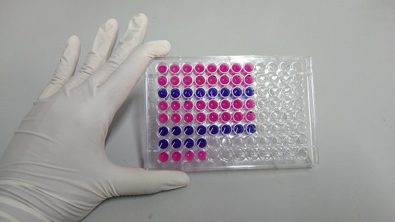 Cropped shot of checking pipette tip box, multi-color of pipette tib box in laboratory.