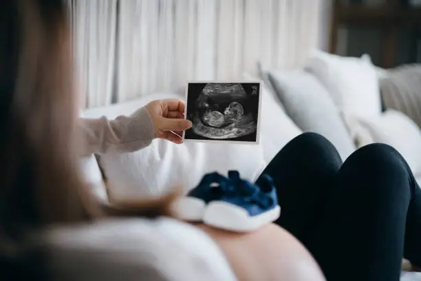 Young Asian pregnant woman lying on sofa at home, looking at the ultrasound scan photo of her baby, with a pair of baby shoes on her belly. Mother-to-be. Expecting a new life concept