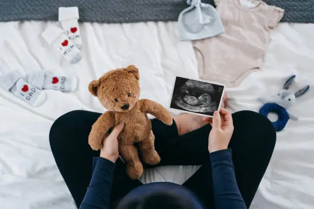 Overhead view of Asian pregnant woman sitting on bed, holding ultrasound scan photo of her baby and soft toy, with baby clothings on the bed. Mother-to-be. Expecting a new life concept