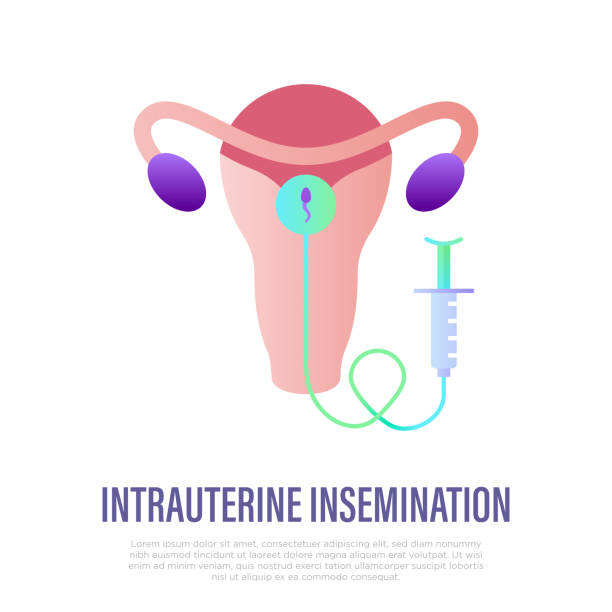 istock Intrauterine insemination flat gradient icon. Gynecology. EGG. Uterus and uterine device. Vector illustration. 1330495166