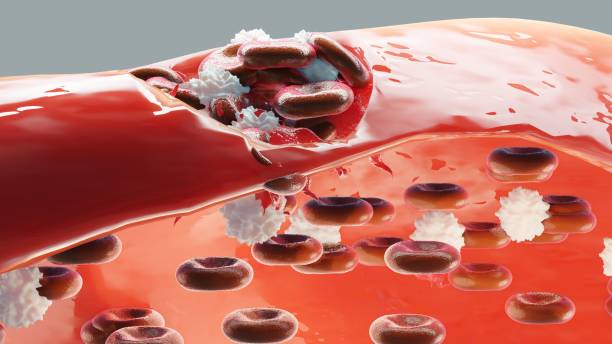 Hemostasis. Red blood cells and platelets in the blood vessel. Basic steps of wound healing process. 3d illustration stock photo
