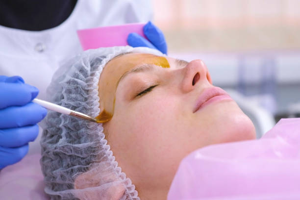 Cosmetologist puts chemical peeling of the woman's face with brush. Cleaning the face skin and lightening freckles skin. Cosmetologist puts chemical peeling of the woman's face with brush. Cleaning the face skin and lightening freckles skin facial chemical peel stock pictures, royalty-free photos & images