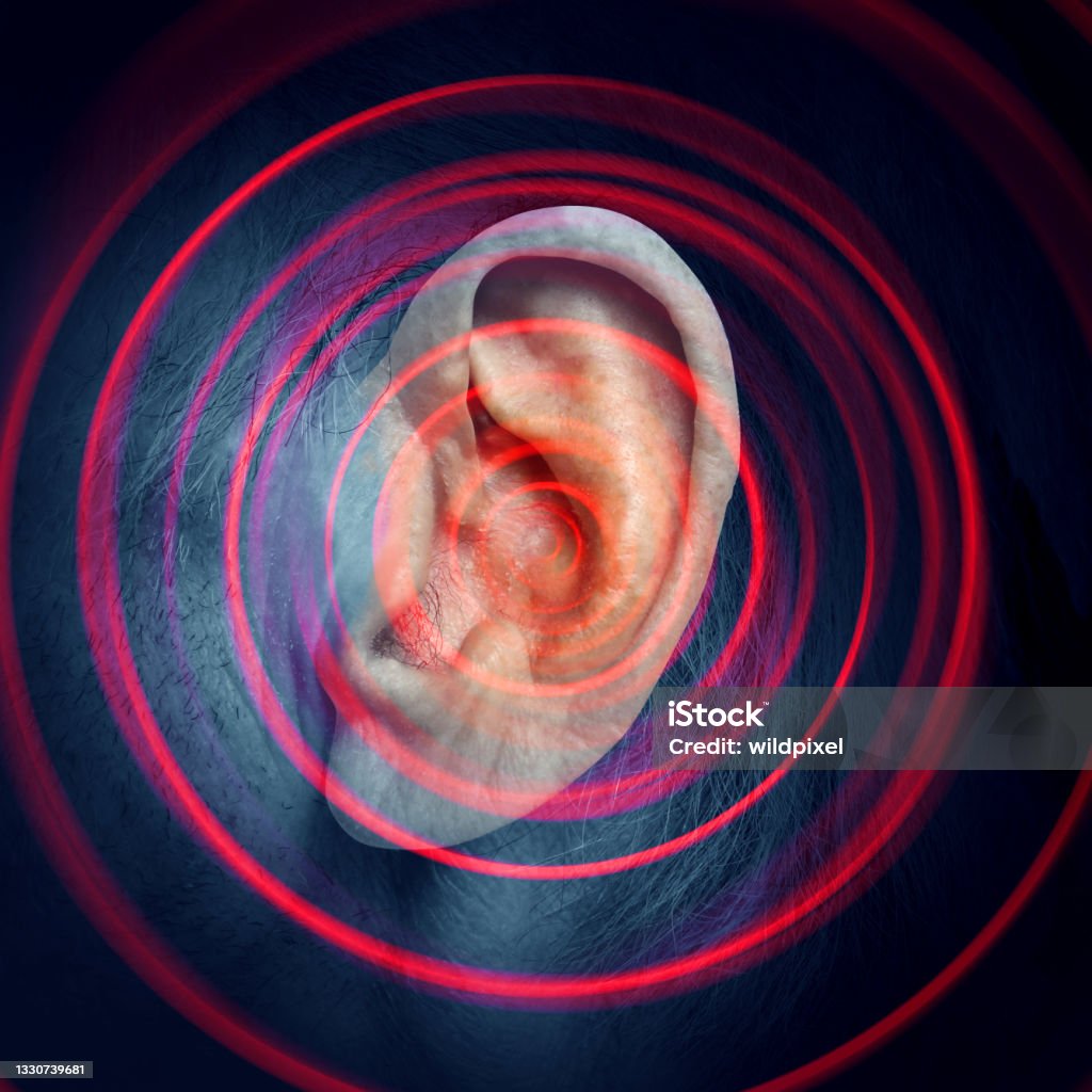 Tinnitus Disease Tinnitus disease as a ringing sound inthe inner ear as a hearing impairment and illness of the ears or painful infection in a 3D illustration style with an abstract radial blur. Tinnitus Stock Photo