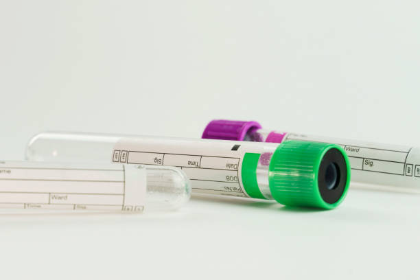 istock vacuum tubes for collection and blood samples on white background.