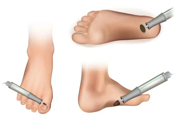 Vector illustration of Apparatus for hardware pedicure. Cutters and Accessories and nail tool on white background.