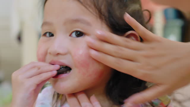 Close-up Baby face having rash usually appears on toddler girl. Allergy red cheek in a child