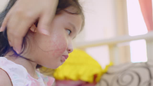 The rash usually appears on toddler girl. Allergy red cheek in a child