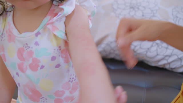The rash usually appears on toddler girl. Allergy red cheek in a child