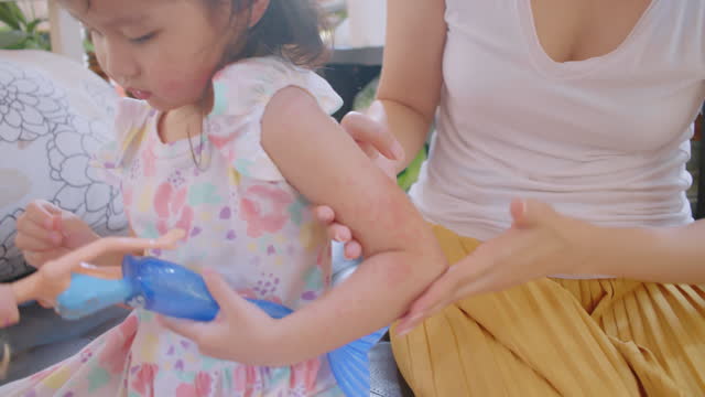 Mother applying lotion to Toddler daughter girl. Allergy red cheek in a child