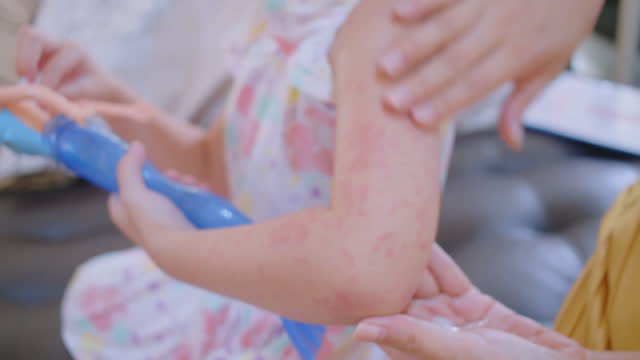 Mother applying lotion to Toddler daughter girl. Allergy red cheek in a child