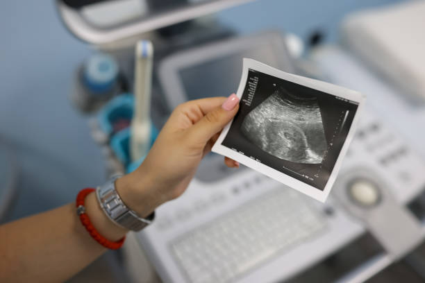 close-up of female doctor's hand holding ultrasound image over ultrasound machine - 體外受精 不育 圖片 個照片及圖片檔
