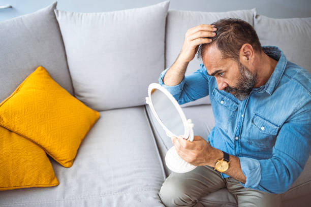 homem de meia idade chateado com alopecia olhando para o espelho - hair loss - fotografias e filmes do acervo