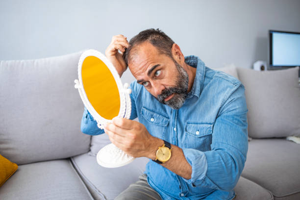 istock Middle-aged man concerned by hair loss. 1331257448